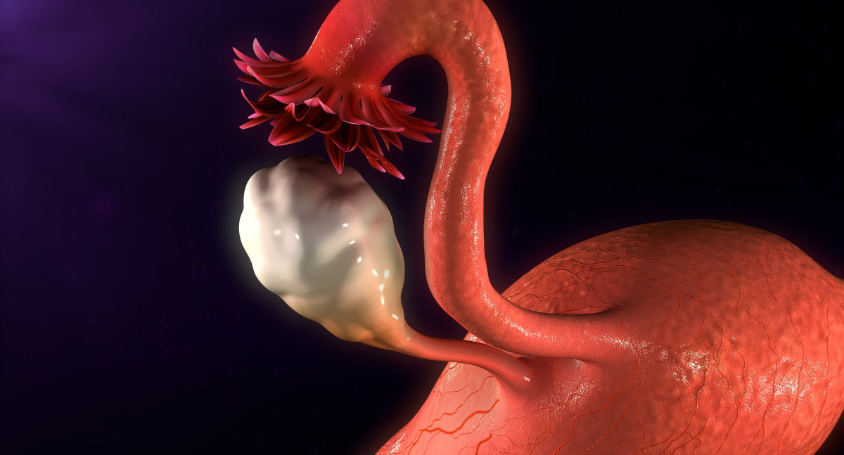 干细胞治疗卵巢早衰